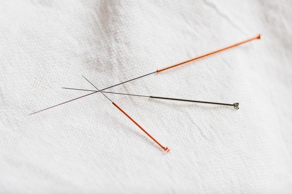 Does Acupuncture Work by Re-Mapping the Brain?, LVBX Magazine